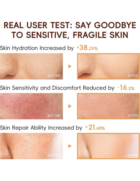 Kit de Cuidado de Piel de Arroz Evolvique para Adolescentes 10-12 Años