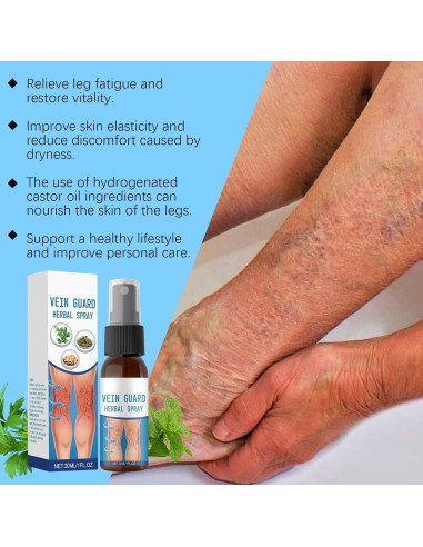Spray Alivio Venas Varicosas Befada 29.57 ml - Fórmula Natural