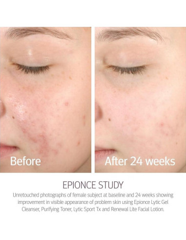 Loción Facial Renovadora Lite Epionce 50ml - Hidratante Anti-Envejecimiento