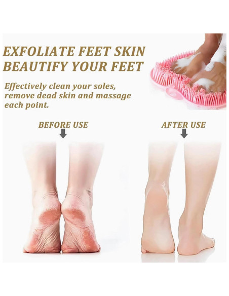 Alfombrilla Exfoliante de Silicona para Pies y Espalda - Genérico
