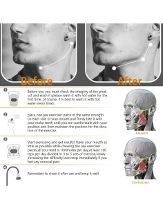Ejercitador de Mandíbula Dongguan 5 Niveles Resistencia 10 Piezas 2