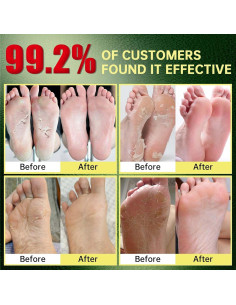 Mascarilla Exfoliante para Pies FLYLEAF - Hidratante y Suave (3 Pzas) 2