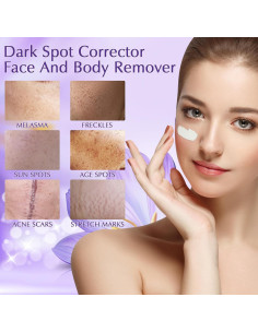 Crema Eliminadora de Manchas Oscuras YRNVK 50ml con Retinol y Vitamina C 2