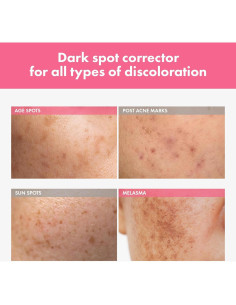 Crema Intensiva para Manchas Tosowoong 20ml - 7% Arbutina 2