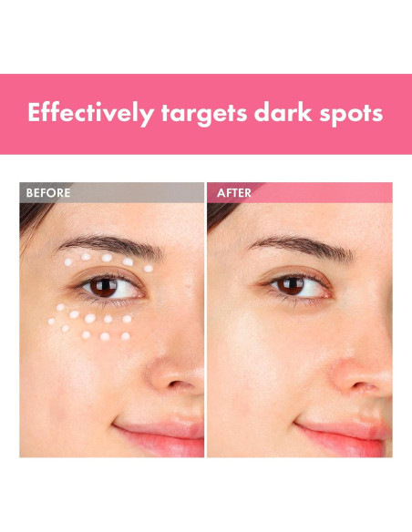 Crema Intensiva para Manchas Tosowoong 20ml - 7% Arbutina