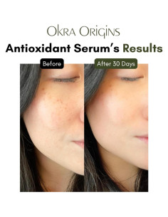Suero Facial Hidratante Okra Origins 10x - Ácido Hialurónico y Niacinamida 2
