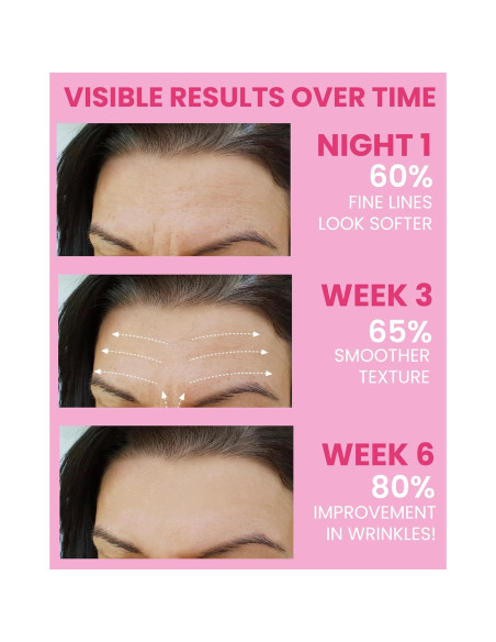 Parches Faciales Antiarrugas Akissos 80PCS - Cuidado Nocturno Parches Faciales Antiarrugas Akissos 80PCS - Cuidado Nocturno