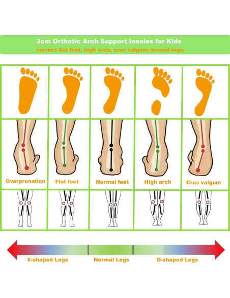 Plantillas ortopédicas Bellcon para niños con soporte de arco alto Plantillas ortopédicas Bellcon para niños con soporte de arco alto