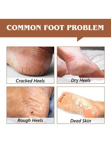 Bálsamo Hidratante para Talones Agrietados ChenYayun 70 ml Coco