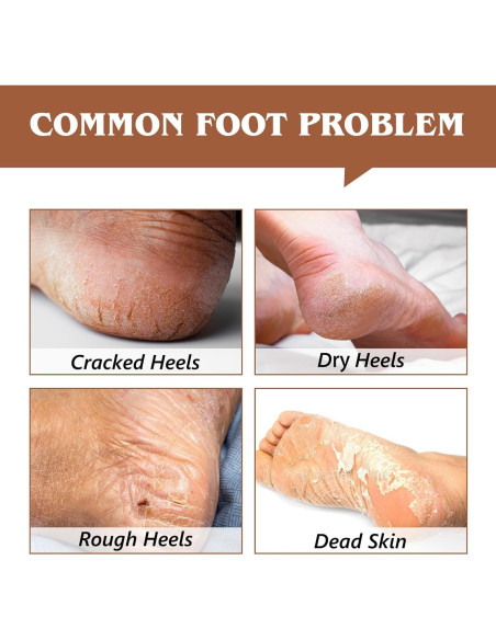 Bálsamo Hidratante para Talones Agrietados ChenYayun 70 ml Coco