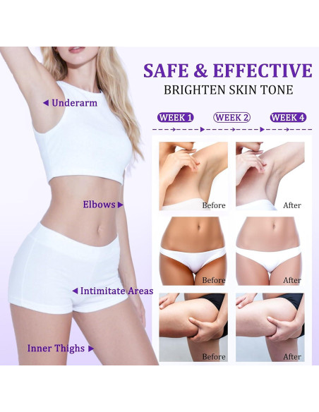 Crema Blanqueadora de Piel con Vitamina C 50ml - Aclara Manchas