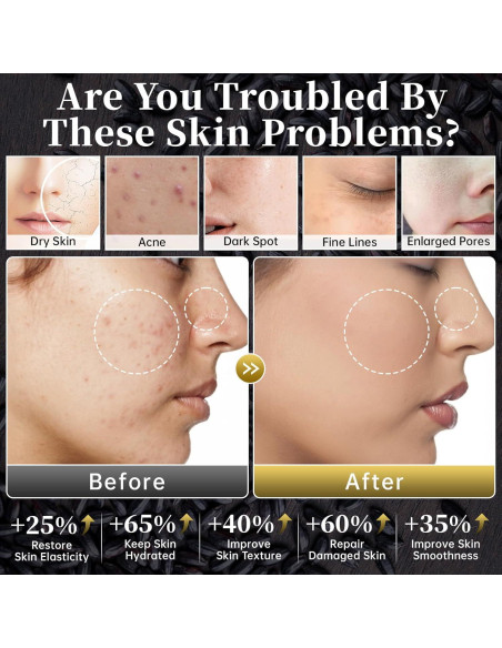 Conjunto de Cuidado de la Piel MIZEEYE 6 PZS Antienvejecimiento