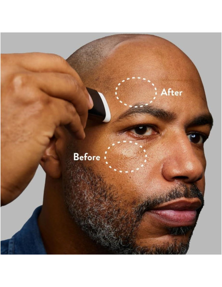 Harry's Anti-Brillo Stick para Piel Grasa - 2 Paquete - 9.9 g