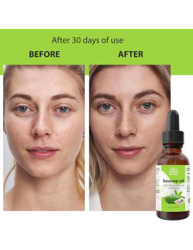 Aceite de Graviola Relaxcation 59 ml - Puro y Virgen para Piel