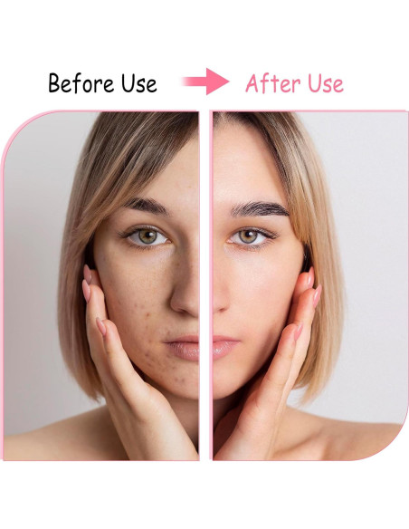 2 Piezas Cepillo Facial de Silicona BOHUIZ Exfoliación Suave