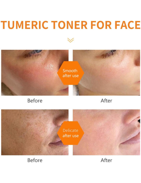 Tónico Facial de Cúrcuma Evolvique 159g - Hidratante y Anti-Envejecimiento