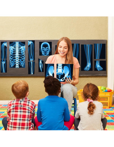 16 Piezas Rayos X Humanos Lineshading Azul para Niños