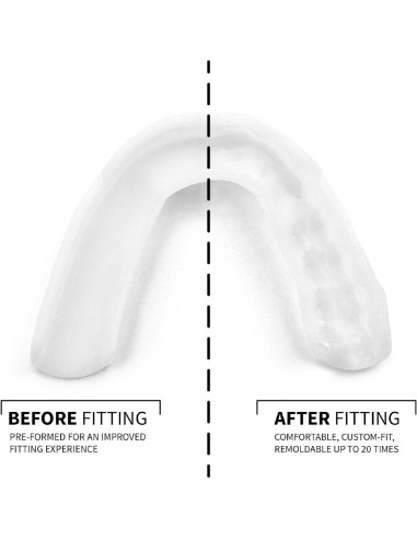 Protector Nocturno SOVA 3D 2.0mm Ajuste Personalizado