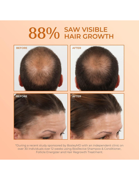 Acondicionador Voluminizador BosRevive 300 ml - Libre de Sulfatos