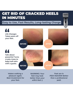 Removedor de Callos Eléctrico Own Harmony CR900 Recargable 2