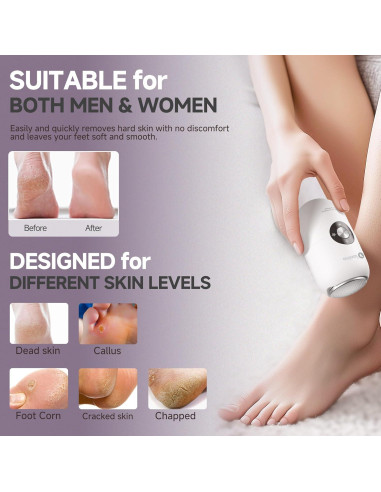 Removedor de Callos Eléctrico CHENGBAITONG Recargable con 2 Cabezas