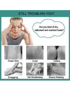 Lima para Pies CAREHOOD 4 en 1 - Pedicura Gris, Exfoliador 2