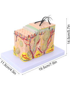 Modelo de Piel Ampliado 35X Tomotato - Herramienta de Enseñanza 2