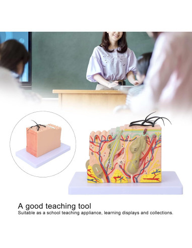 Modelo de Piel Ampliado 35X Tomotato - Herramienta de Enseñanza