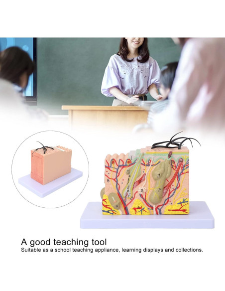 Modelo de Piel Ampliado 35X Tomotato - Herramienta de Enseñanza