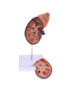 Modelo de Anatomía del Riñón Agatige, Tamaño Real, Dividido en 2 Partes
