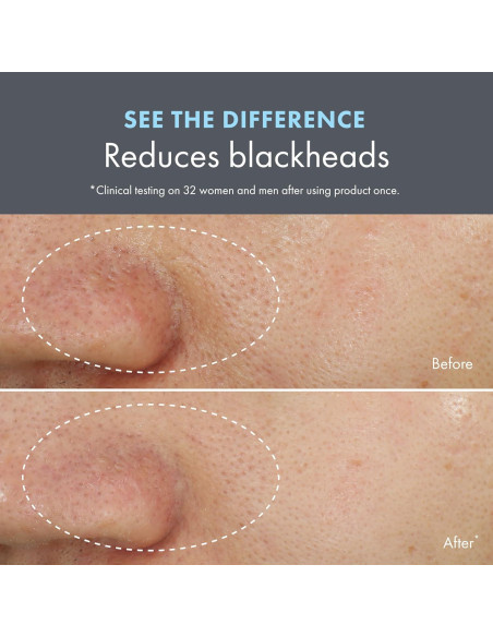 Mascarilla y Exfoliante Facial Origins Clear Improvement 73.93 ml