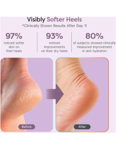 Bálsamo Natural para Pies ZenToes 56.7g - Hidratante Talones Secos 2