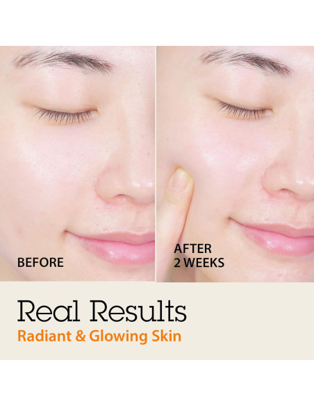 Conjunto Suero Facial Blithe Albaricoque y Chaga 99.2 ml