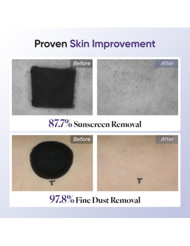 Limpiador Facial Espumoso RAWQUEST 150 ml - Exfoliante Diario