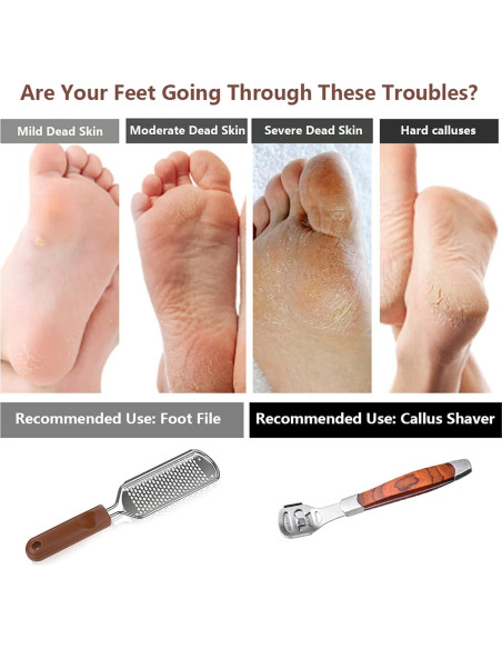 Kit de Lima para Pies Vusoset - Raspador y Afilador de Callos Kit de Lima para Pies Vusoset - Raspador y Afilador de Callos