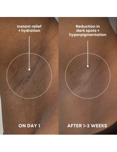 Exfoliante Corporal Bushbalm Bermuda 236 ml - Manchas Oscuras