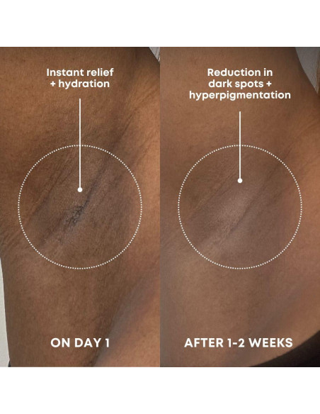 Exfoliante Corporal Bushbalm Bermuda 236 ml - Manchas Oscuras Exfoliante Corporal Bushbalm Bermuda 236 ml - Manchas Oscuras