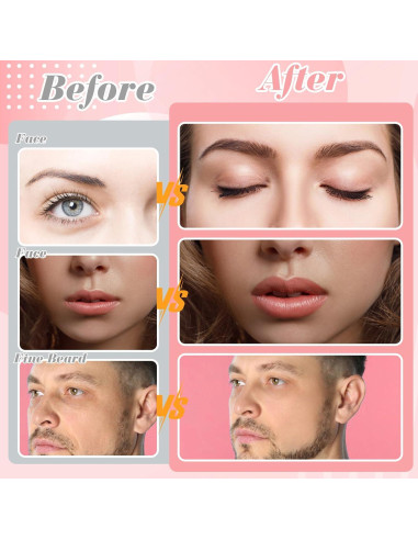 Cuchillas Dermaplane ProSuites 16 Piezas para Vello Facial