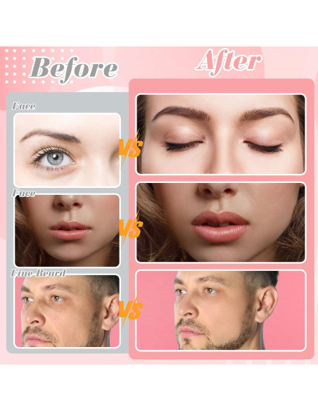 Cuchillas Dermaplane ProSuites 16 Piezas para Vello Facial