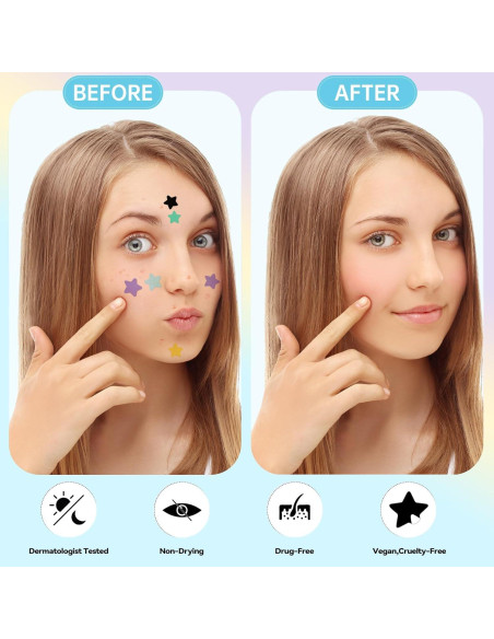 Parche para Granos Waspot Estrella Hidrocoloide 240 Unidades