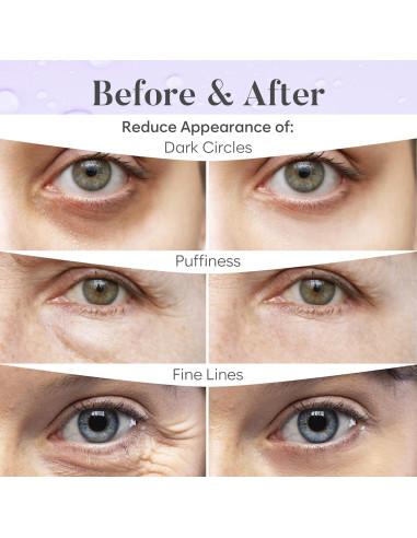 Parches para Ojos Bloomora - Hidratación Día y Noche (30 Pares)