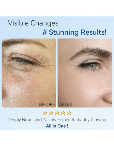 Crema Hidratante Antienvejecimiento UFEEK 39.9 ml con Retinol