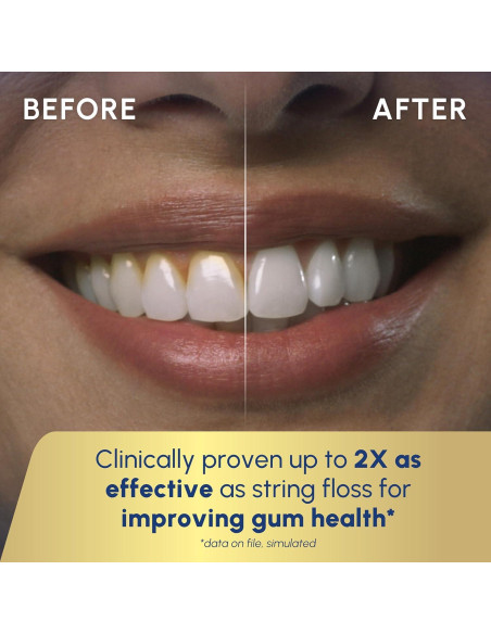 Irrigador Dental Inalámbrico Waterpik ION WF-12 Negro, 10 Configuraciones Irrigador Dental Inalámbrico Waterpik ION WF-12 Negro, 10 Configuraciones