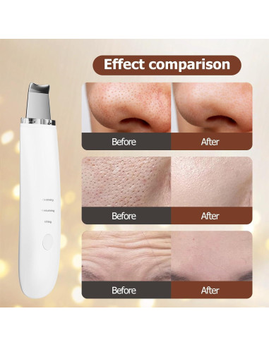 Espátula Facial Limpiadora Sawjay - 3 Modos para Piel Radiante