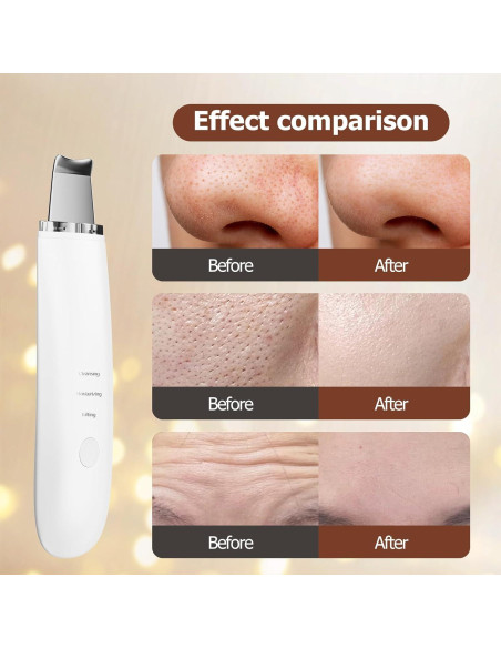 Espátula Facial Limpiadora Sawjay - 3 Modos para Piel Radiante