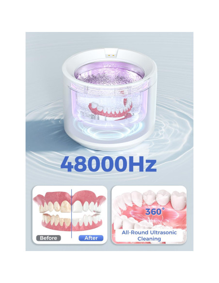Limpiadora Ultrasónica 48000Hz Acmeenjoy 200ML con Luz UV