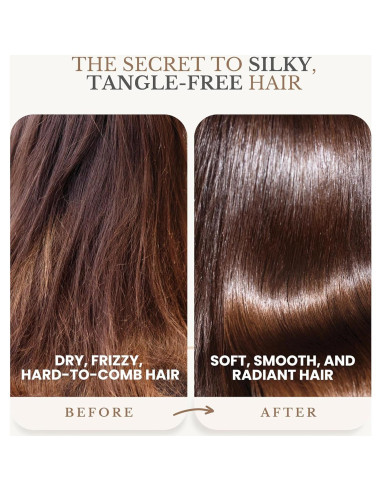 Acondicionador de Aceite de Romero Edenika 473 ml - Anti-Pérdida