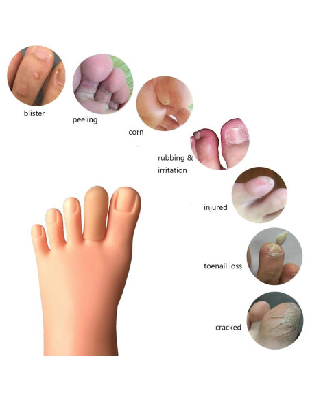 16 Protectores de Dedos Conpru de Goma SEBS para Callos y Ampollas