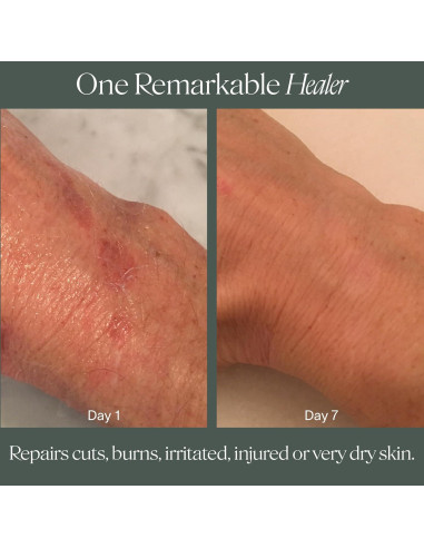 Bálsamo Sanador Restore Doctor Rogers 28g Multiusos Eccema