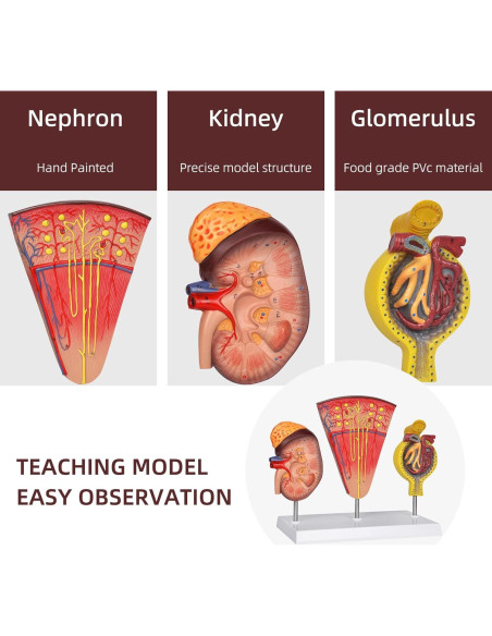 Modelo Anatómico de Riñón 3-en-1 Simedutech para Estudio